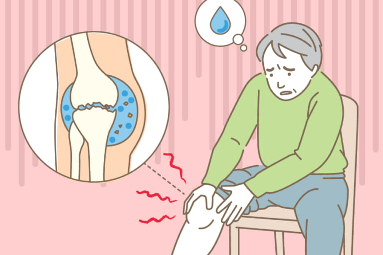 膝に水が溜まったらすぐ対処しましょう 専門医が理由を解説 ひざ関節症クリニック