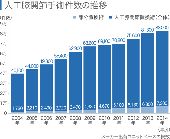 人工膝関節置換術の術後について【合併症と生活上の注意点】│ひざ関節症クリニック