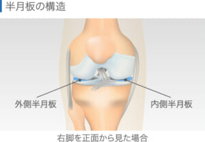 半月板損傷は自然治癒しない？保存療法から手術療法まで有効な治療法を解説│ひざ関節症クリニック