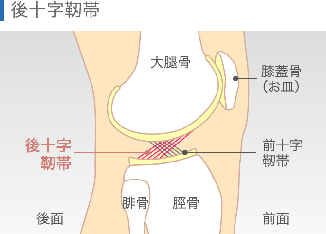 ひざの裏が痛くなるのはなぜ 医師が教える原因と対処法 ひざ関節症クリニック