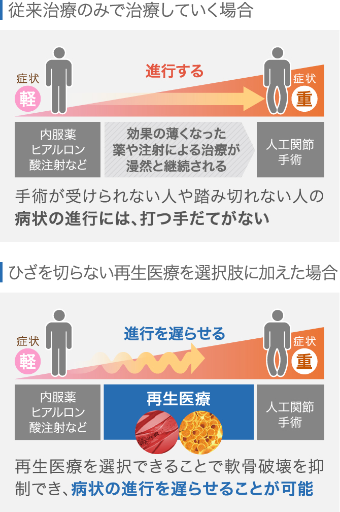 変形性膝関節症の治し方を徹底解説！治療ごとのメリット・デメリットは？│ひざ関節症クリニック