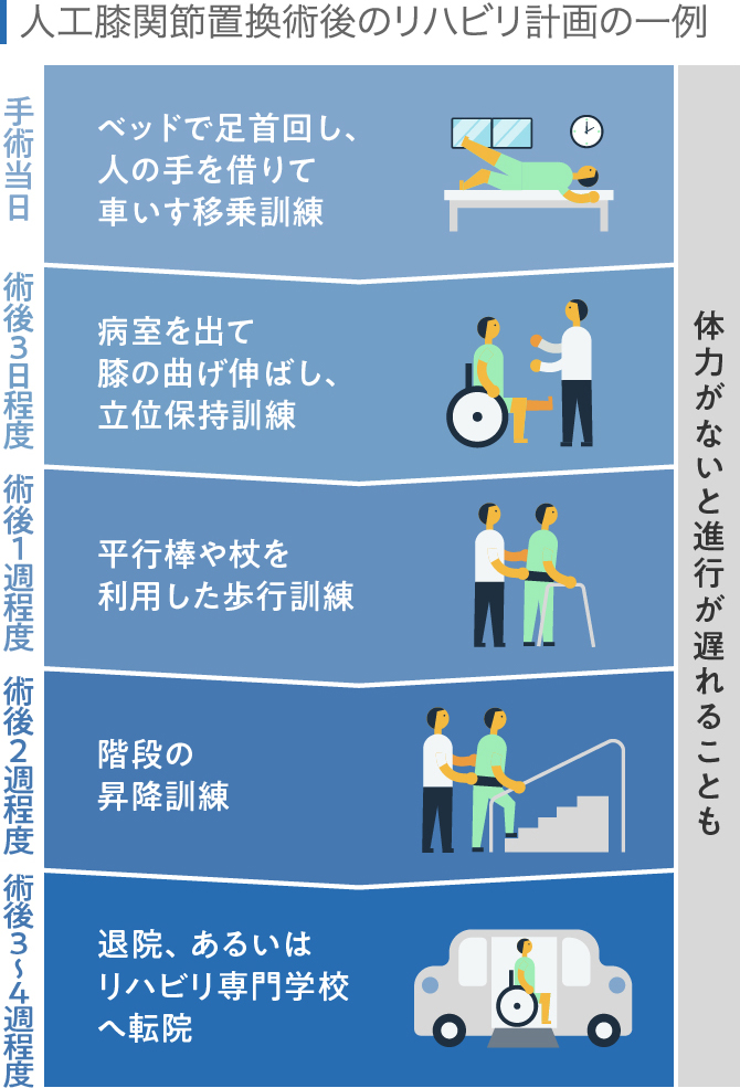 変形性膝関節症の手術の高齢者リスクを医師が分析｜80代以上は要注意？