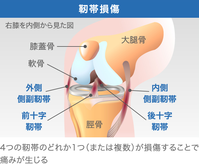 膝が急に痛くなる原因は？【考えられる10の原因とその解決法】