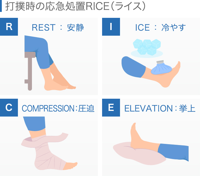 膝が腫れたらどうすべき 考えられる病気と原因別対処法