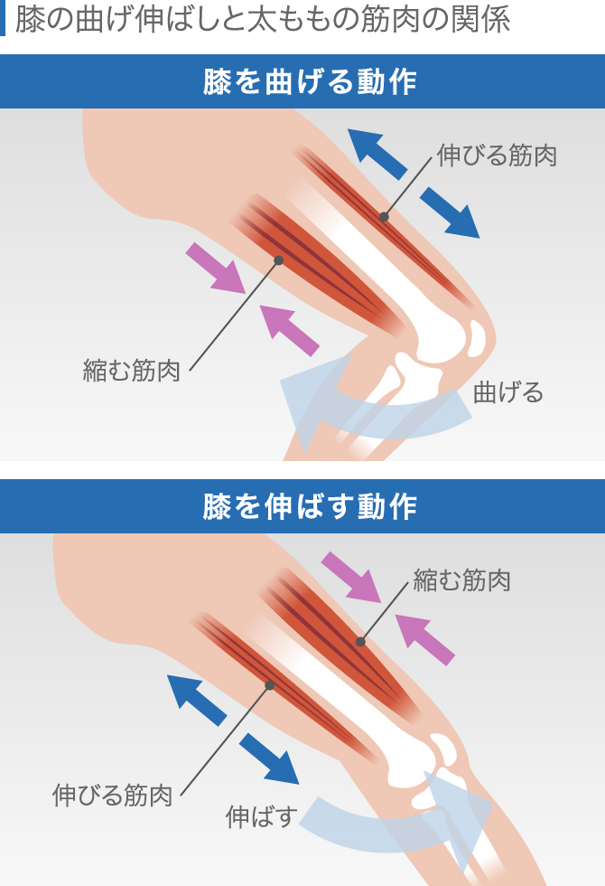 膝の違和感の症状チェック 痛くないけど気になる原因と対処法