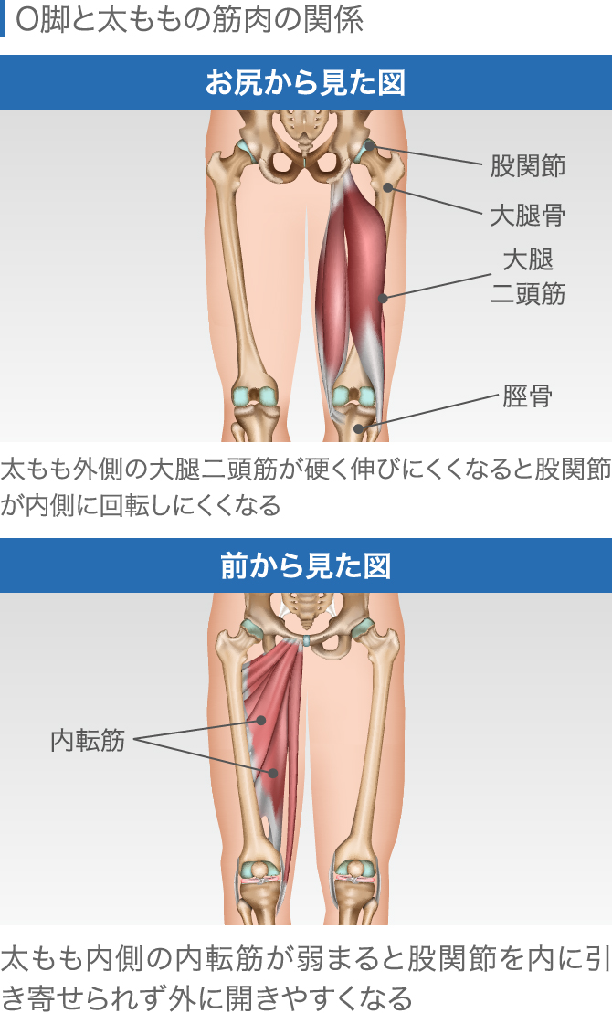 膝の違和感の症状チェック 痛くないけど気になる原因と対処法