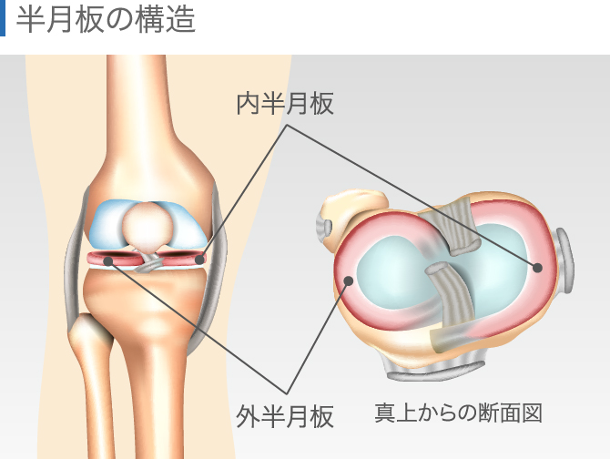 膝の違和感の症状チェック 痛くないけど気になる原因と対処法