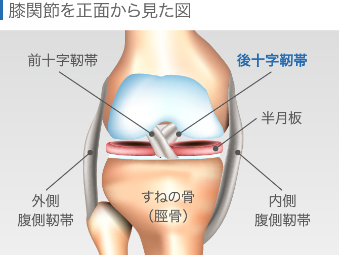 後十字靭帯損傷の放置は危険【症状・治療法・リハビリを解説】