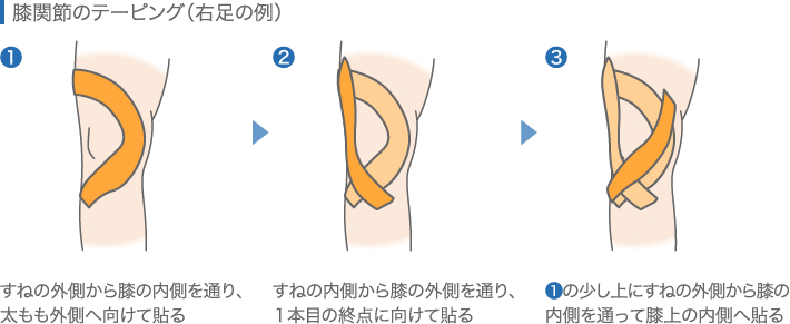 膝関節のテーピング（右足の例）